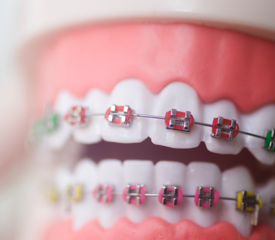 Children's Dentistry