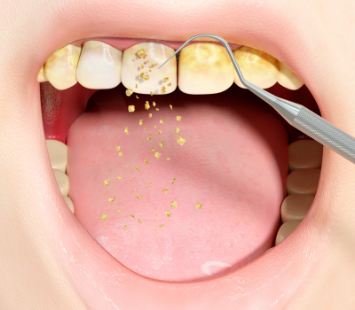 Children's Dentistry