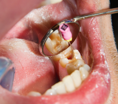 Children's Dentistry