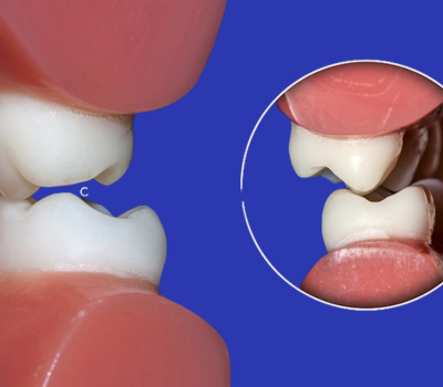 Children's Dentistry