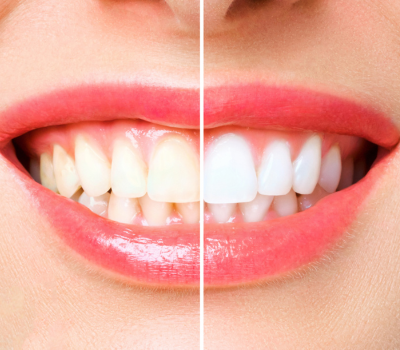 Children's Dentistry