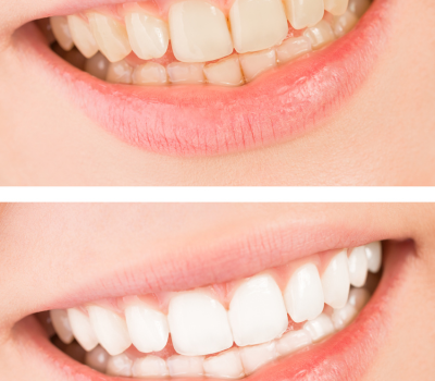 Children's Dentistry